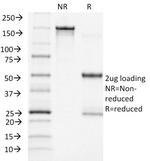 ACTH (Adrenocorticotrophic Hormone) Monoclonal Antibody (CLIP/1418)