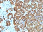 ACTH (Adrenocorticotrophic Hormone) Monoclonal Antibody (CLIP/1449)