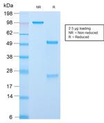 ACTH (Adrenocorticotrophic Hormone) Antibody in SDS-PAGE (SDS-PAGE)