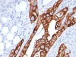 Cytokeratin 20 (KRT20) (Colorectal Epithelial Marker) Monoclonal Antibody (KRT20/1991)