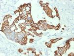 Cytokeratin 20 (KRT20) (Colorectal Epithelial Marker) Monoclonal Antibody (KRT20/1992)