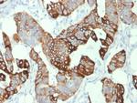 Cytokeratin 20 (KRT20) Monoclonal Antibody (KRT20, 1993)