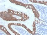 Cytokeratin 20 (KRT20) (Colorectal Epithelial Marker) Monoclonal Antibody (KRT20/3145)