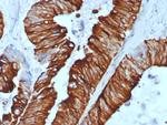 Cytokeratin 20 (KRT20) (Colorectal Epithelial Marker) Recombinant Rabbit Monoclonal Antibody (KRT20/7805R)