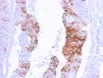 Cytokeratin 20 (KRT20) Recombinant Rabbit Monoclonal Antibody (KRT20, 3129R)