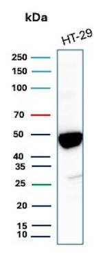 Cytokeratin 20 (KRT20) (Colorectal Epithelial Marker) Recombinant Rabbit Monoclonal Antibody (KRT20/3224R)