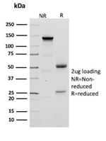 Cytokeratin 20 (KRT20) (Colorectal Epithelial Marker) Antibody in SDS-PAGE (SDS-PAGE)