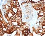 Cytokeratin 20 (KRT20) (Colorectal Epithelial Marker) Recombinant Rabbit Monoclonal Antibody (KRT20/4380R)
