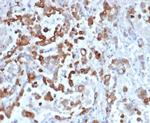 Cytokeratin 20 (KRT20) (Colorectal Epithelial Marker) Recombinant Rabbit Monoclonal Antibody (KRT20/4879R)