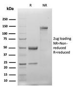 Cytokeratin 20 (KRT20) (Colorectal Epithelial Marker) Antibody in SDS-PAGE (SDS-PAGE)