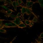 PRMT7 Monoclonal Antibody (PCRP-PRMT7-1A4)