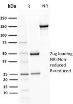 BOB.1 Antibody in SDS-PAGE (SDS-PAGE)