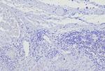 BOB.1 (B-Cell Marker) Antibody in Immunohistochemistry (Paraffin) (IHC (P))