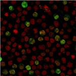 BOB.1 Monoclonal Antibody (BOB1, 2424)