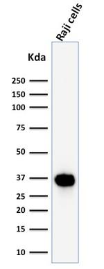 BOB.1 Antibody in Western Blot (WB)