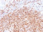 OCT-2 (POU2F2) Monoclonal Antibody (86839)