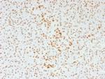 ATRX/RAD54 (Alpha Thalassemia Mental Retardation) Monoclonal Antibody (39f)