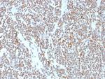 ATRX/RAD54 (Alpha Thalassemia Mental Retardation) Monoclonal Antibody (ATRX/7940)