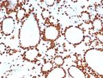 PET1/FEV Monoclonal Antibody (FEV/7311)