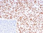 PET1/FEV Monoclonal Antibody (FEV/7311)