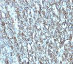 Migfilin-1/FBLIM1 Antibody in Immunohistochemistry (Paraffin) (IHC (P))