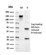 Migfilin-1/FBLIM1 Antibody in SDS-PAGE (SDS-PAGE)
