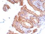 Migfilin-1/FBLIM1 Recombinant Rabbit Monoclonal Antibody (FBLIM1/8189R)