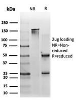 ZNF562 (Transcription Regulator) Antibody in SDS-PAGE (SDS-PAGE)