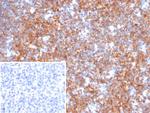 BCOR Monoclonal Antibody (BCOR/2372)