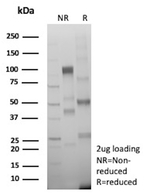 BCOR Antibody in SDS-PAGE (SDS-PAGE)