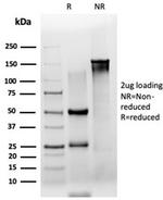 ZSCAN2 (Transcription Factor) Antibody in SDS-PAGE (SDS-PAGE)