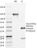 Prostate Specific Acid Phosphatase (PSAP) Antibody in SDS-PAGE (SDS-PAGE)