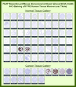 Prostate Specific Acid Phosphatase (PSAP) Recombinant Mouse Monoclonal Antibody (MSVA-452M)