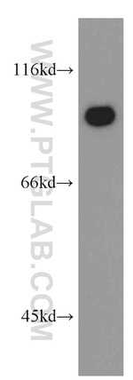 LIN41 Antibody in Western Blot (WB)