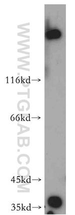 HTRA1 Antibody in Western Blot (WB)