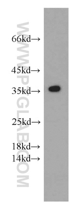 SCGF Antibody in Western Blot (WB)