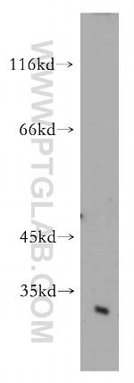 Cathepsin D Antibody in Western Blot (WB)