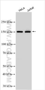 UPF2 Antibody in Western Blot (WB)