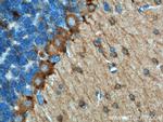 Adenosine A1 Receptor Antibody in Immunohistochemistry (Paraffin) (IHC (P))