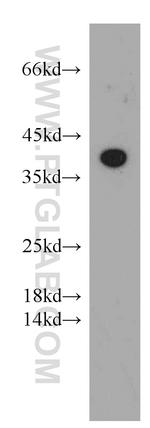 Adenosine A1 Receptor Antibody in Western Blot (WB)