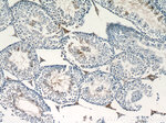 Adenosine A1 Receptor Antibody in Immunohistochemistry (Paraffin) (IHC (P))