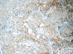 CSPG4/NG2 Antibody in Immunohistochemistry (Paraffin) (IHC (P))