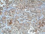 CSPG4/NG2 Antibody in Immunohistochemistry (Paraffin) (IHC (P))