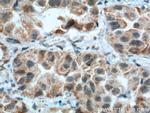 CSPG4/NG2 Antibody in Immunohistochemistry (Paraffin) (IHC (P))