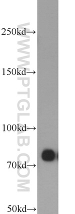PFKM Antibody in Western Blot (WB)