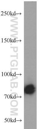 PFKM Antibody in Western Blot (WB)