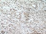 MKK7 Antibody in Immunohistochemistry (Paraffin) (IHC (P))