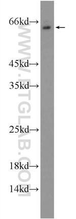 MKK7 Antibody in Western Blot (WB)