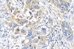 GBX1 Antibody in Immunohistochemistry (Paraffin) (IHC (P))