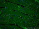 GBX1 Antibody in Immunohistochemistry (PFA fixed) (IHC (PFA))